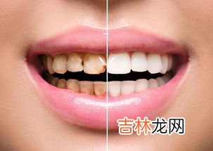快速去牙齿烟渍小妙招,怎样去除牙上的烟渍？什么美白方法最好用?我好像陷进一个无法自拔的漩涡啊！