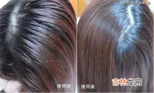 淋雨的头发必须当天洗吗,雨水可以洗头吗?