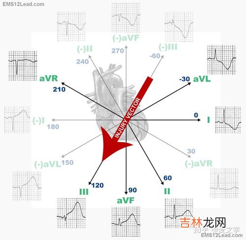 人体承受的最大电压,人体安全电压是多少