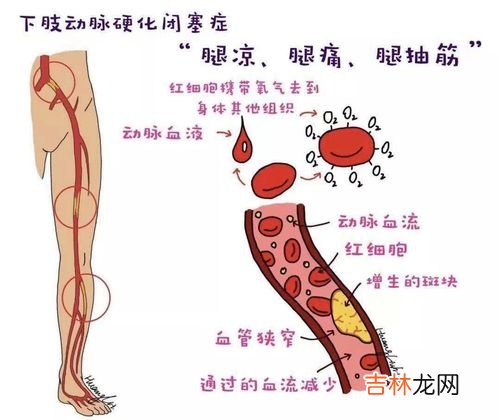 创刻的动脉剧情攻略,谁玩过创刻的动脉，被虐的好惨，求大神帮忙