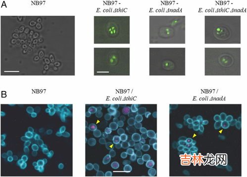 草履虫有叶绿体吗,草履虫身体内没有的结构是