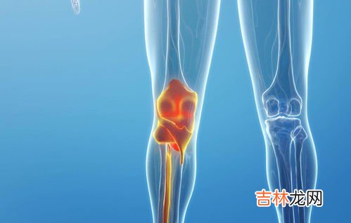 氨糖软骨素哪个品牌好,氨糖软骨素钙片哪个牌子效果好