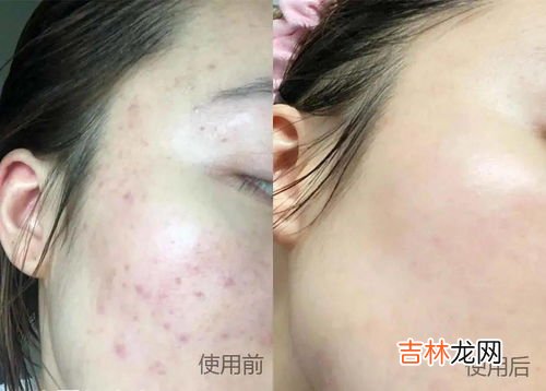 按摩乳怎么用,按摩乳的使用方法和洗面奶一样吗？我都把按摩乳合水摩搓涂在脸上，再用清水洗脸