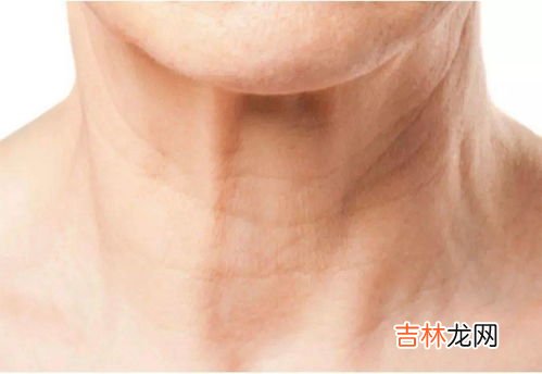 皱纹的雅称,皱纹的叫法是一道一道还是一圈一圈的?