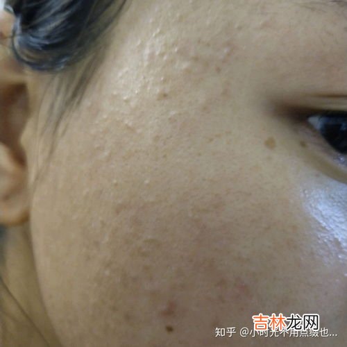 闭口是什么东西,闭口是什么