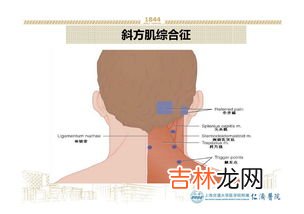 为什么后背痛是什么原因造成的,后背疼痛是什么原因?