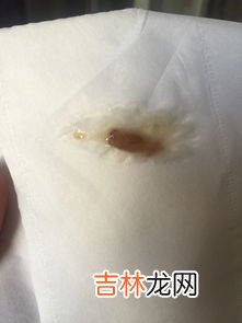 鼻子为什么一个通气一个不通气,为什么我每次只有一个鼻孔通气