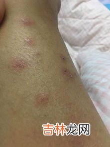 为什么会有皮肤病,狗狗为什么会皮肤病