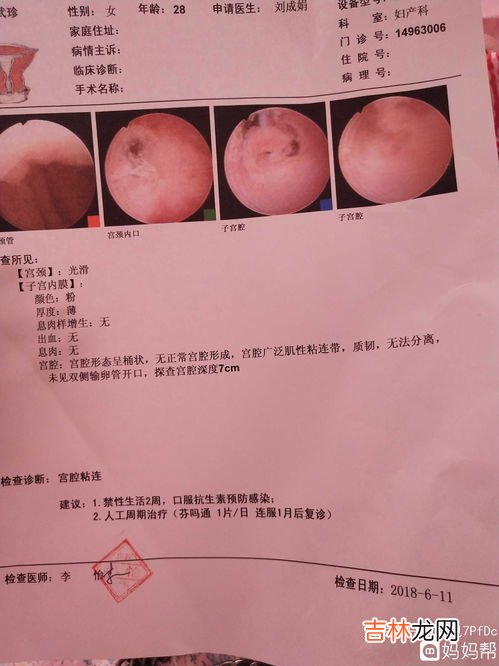 为什么局麻宫腔镜还疼,宫腔镜手术全麻醒了还会痛吗