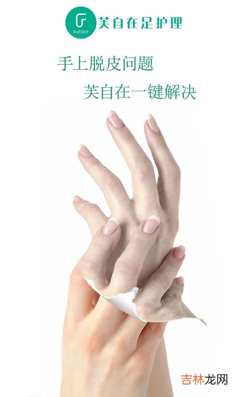 手脱皮是为什么,手脱皮有哪些原因?