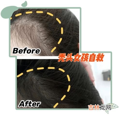 下面又痒又臭为什么呢,下面瘙痒有异味是什么原因?