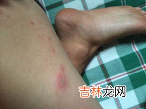 下面又痒又臭为什么呢,下面瘙痒有异味是什么原因?