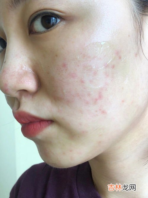 下面又痒又臭为什么呢,下面瘙痒有异味是什么原因?