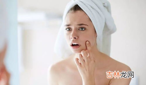 为什么有些人不长痘痘,为什么有的人会起青春痘而有的人不会呢？