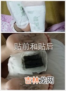 瘦身贴效果好吗,瘦身贴有用吗