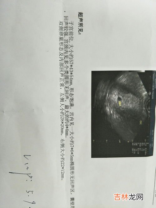 为什么会葡萄胎,孕期出现哪些症状，孕妈要警惕怀上“葡萄胎”？