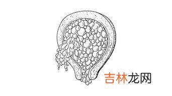 为什么会葡萄胎,孕期出现哪些症状，孕妈要警惕怀上“葡萄胎”？