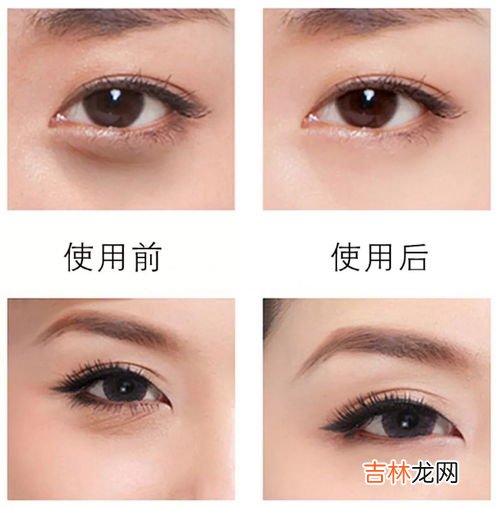 去黑眼圈眼膜可以天天敷吗,眼膜天天敷好不好