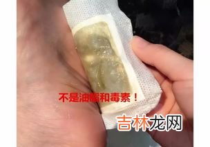 足贴变黑真的排毒吗,足贴变黑的原理是什么