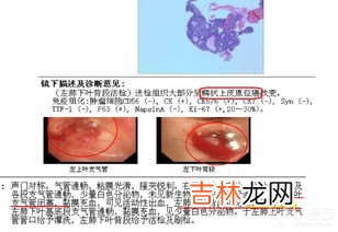 左行气右行血什么意思,用益草汉方泡脚包来泡脚的时候为什么要分男左女右？