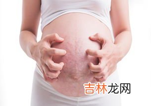 为什么腿上会有妊娠纹,为什么大腿上有妊娠纹