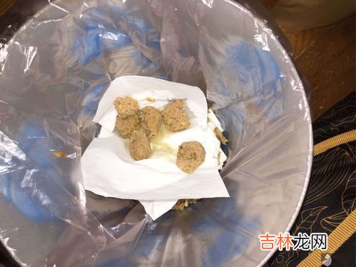 为什么分泌物有腥臭味,下体有腥臭味是什么原因？