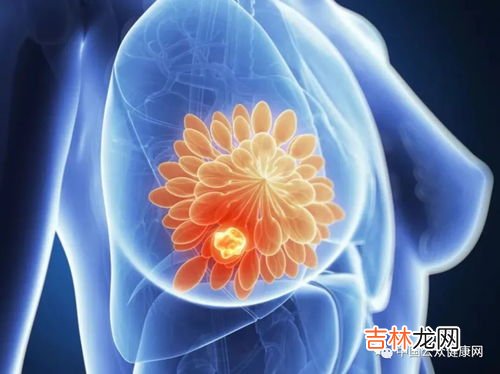 百结开治乳腺结节的功效,乳腺结节3级吃什么药