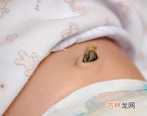 肚脐眼黑是因为什么,为什么我的肚脐眼里有很多黑黑的东西？