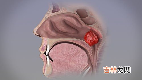 小孩为什么会腺样体肥大,腺样体肥大是什么原因造成的？