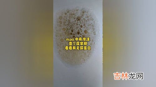 为什么尿液有泡沫,尿尿泡沫很多是怎么回事