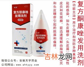 酮康唑洗剂可以当洗发水用吗,脂溢性脱发用什么洗发水好