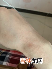 为什么手突然很痒,手指莫名其妙的痒是怎么回事