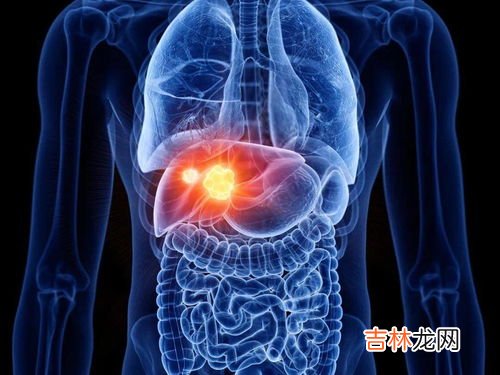 为什么会得肝硬化,健康的肝脏是如何一步步沦落到肝硬化的？我们该如何保护自己的肝脏？