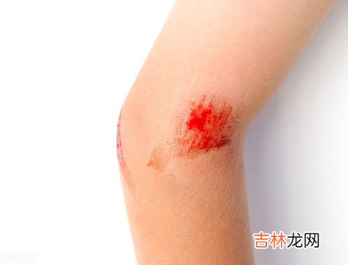 为什么会得肝硬化,健康的肝脏是如何一步步沦落到肝硬化的？我们该如何保护自己的肝脏？
