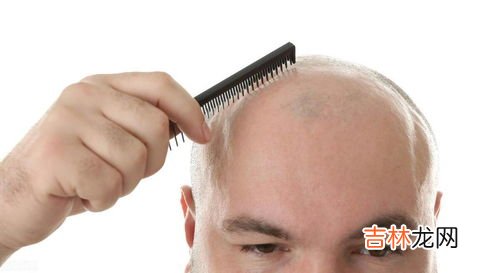 为什么每天掉好多头发,为什么每天掉很多头发
