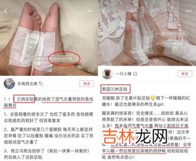 日本足贴去湿气是真的吗,足贴的原理是什么 真的可以去湿气吗