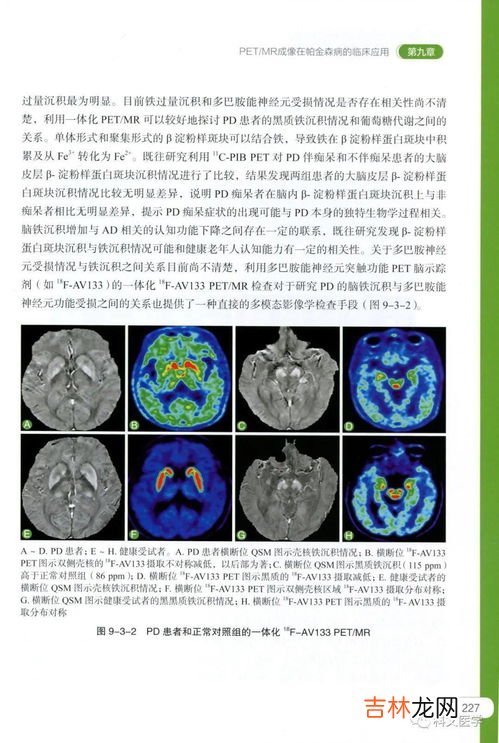 甘甲密骨片的作用与功效,地龙骨的功效与作用