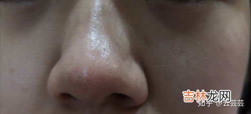 去黑头药膏怎么用法,去黑头药膏怎么用法