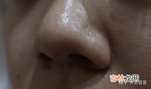 去黑头药膏怎么用法,去黑头药膏怎么用法