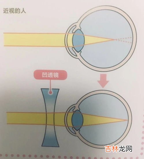 电影院近视眼的3d眼镜怎么戴,眼睛近视看3d电影有影响吗?戴近视眼镜再戴那个眼睛该怎么弄啊?