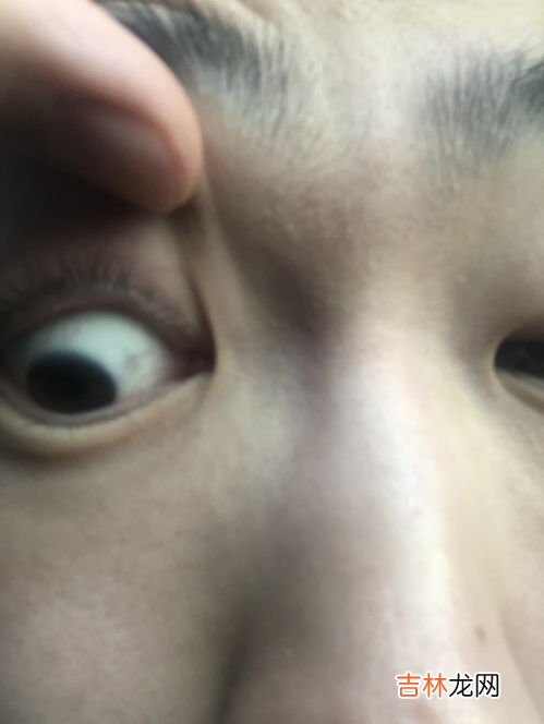 为什么眼白有黑色点点,孩子眼白为啥有“黑点”?可能是3种原因所致,看看自家娃有吗?