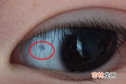 为什么眼白有黑色点点,孩子眼白为啥有“黑点”?可能是3种原因所致,看看自家娃有吗?