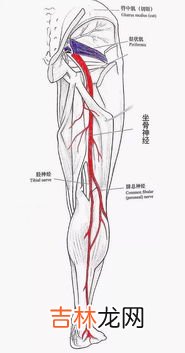 为什么坐骨神经痛,坐骨神经痛是怎么引起的？