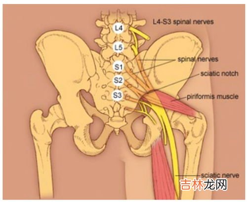 为什么坐骨神经痛,坐骨神经痛是怎么引起的？