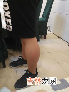 小腿围36算粗吗,身高170CM，小腿周长36CM，腿粗吗？