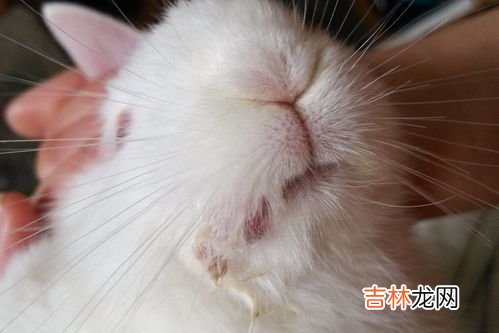 人为什么会长癣是什么原因,为啥皮肤会常常长皮癣，怎么办？已经很注意个人卫生了!